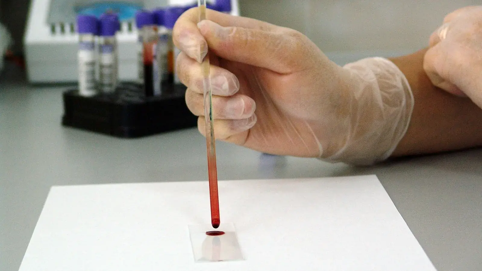 Behandschuhte Hand gibt mit einer Pipette Blut auf einen Objektträger, dahinter Röhrchen im Ständer