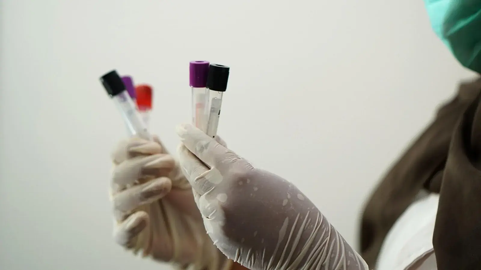 Behandschuhte Hände halten Blutröhrchen mit schwarzen, violetten und roten Verschlüssen