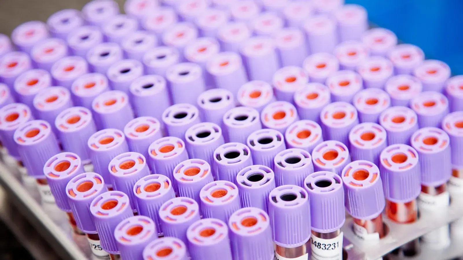 Viele Blutröhrchen mit violetten Verschlusskappen dicht nebeneinander in einem Ständer