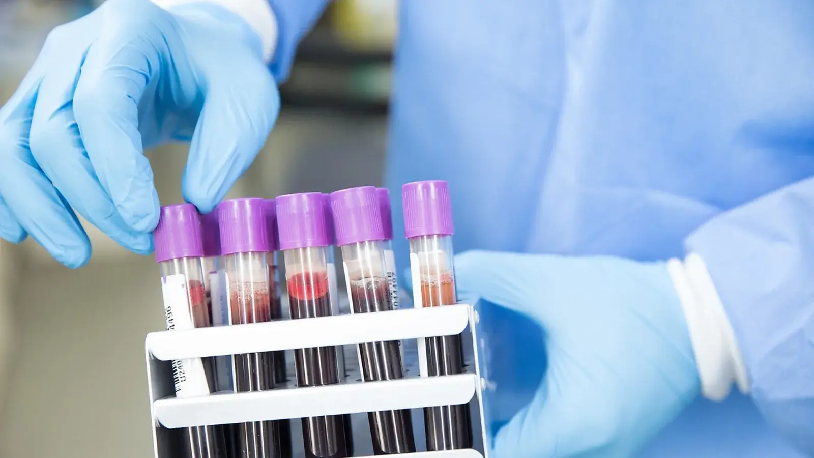 Hände in blauen Handschuhen halten ein Gestell mit Blutröhrchen mit violetten Verschlüssen