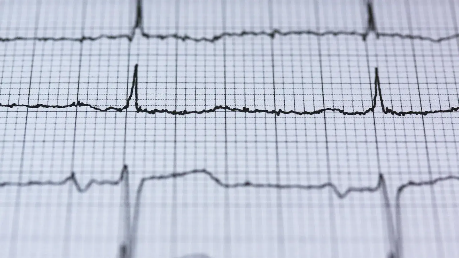 EKG-Streifen auf rosa Millimeterpapier mit regelmäßigen Herzschlagkurven