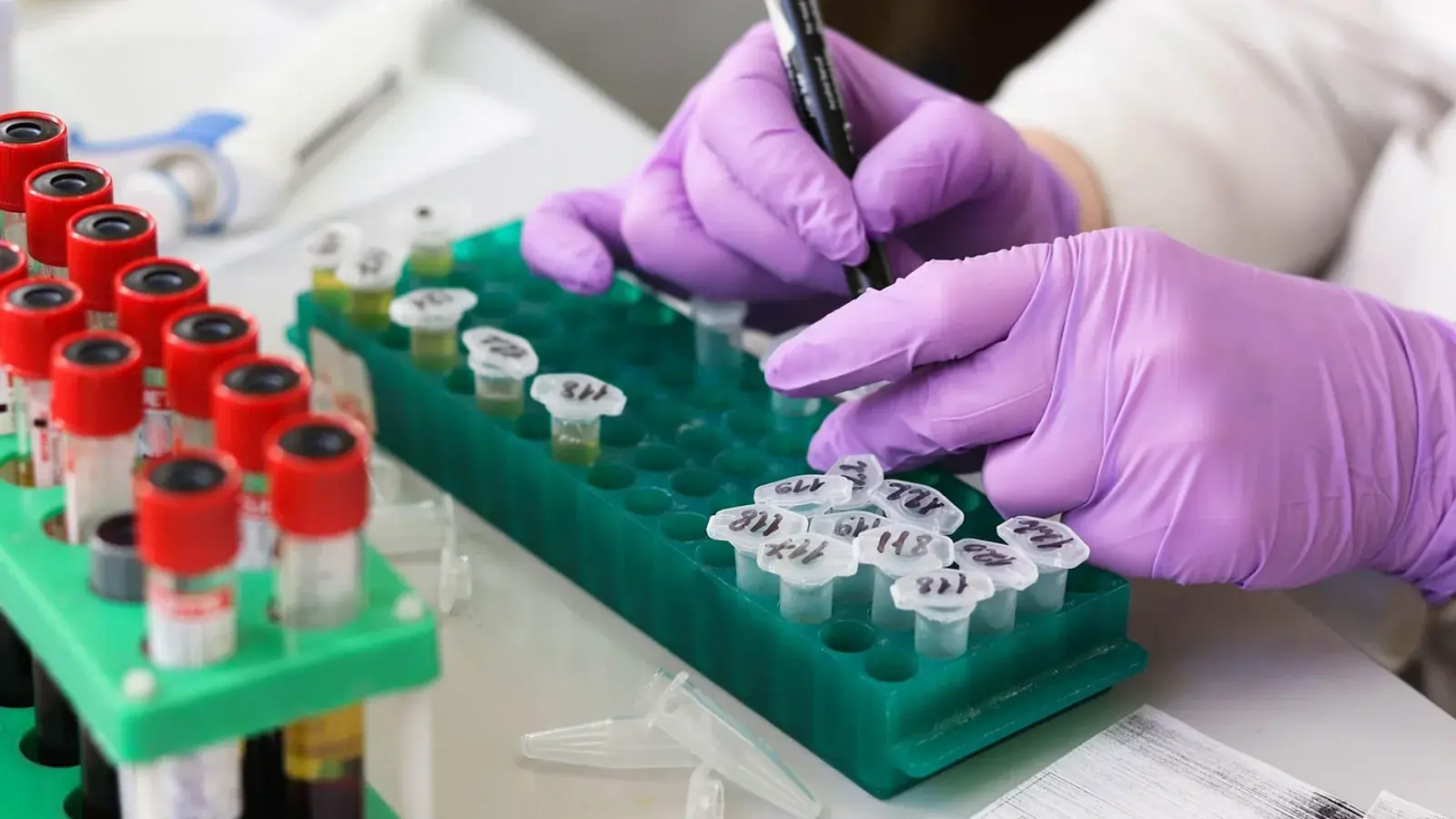 Hände in violetten Handschuhen beschriften Probengefäße neben einem Gestell mit Blutröhrchen